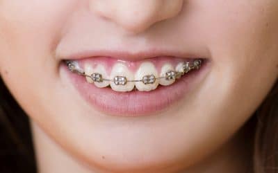 Orthodontie pour enfants et adultes : remboursements et solutions